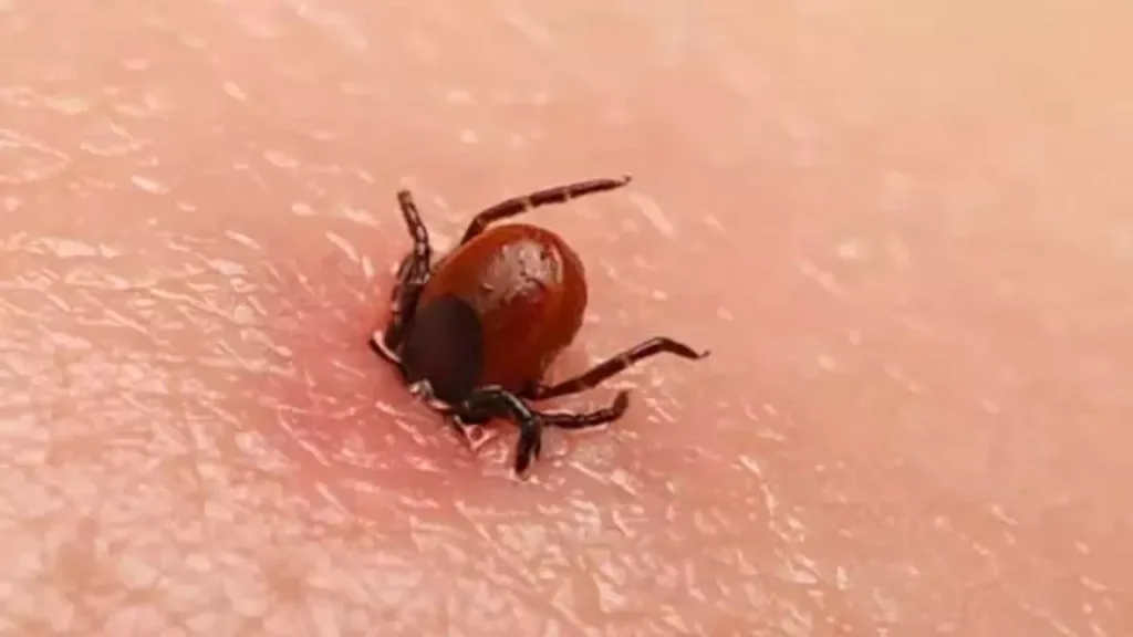 Kene Isırması Nedir ? Kene Isırığı Belirtileri ve Tedavisi ?