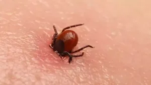 Kene Isırması Nedir ? Kene Isırığı Belirtileri ve Tedavisi ?